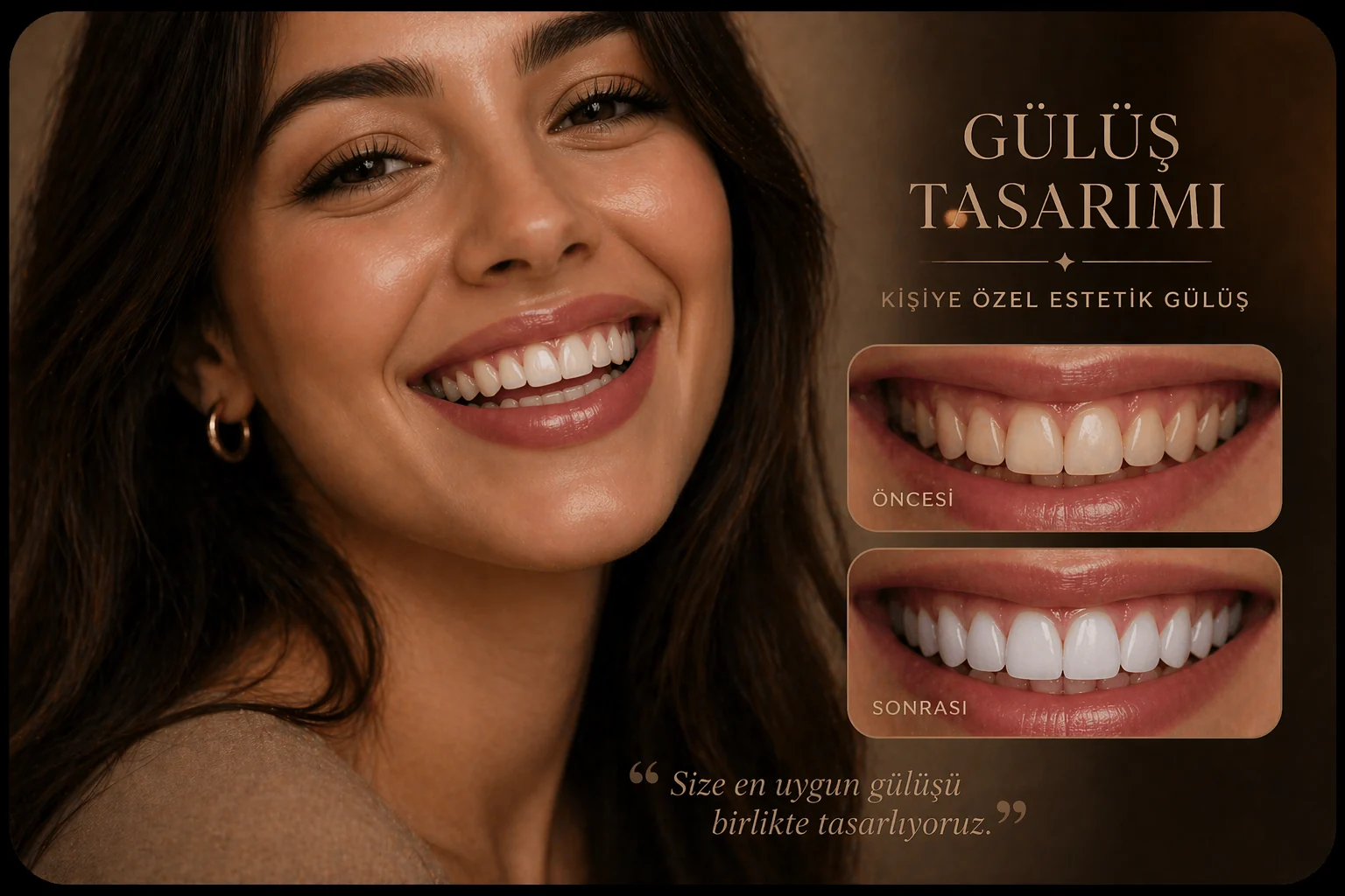 Kampanya görseli · Gülüş tasarımı